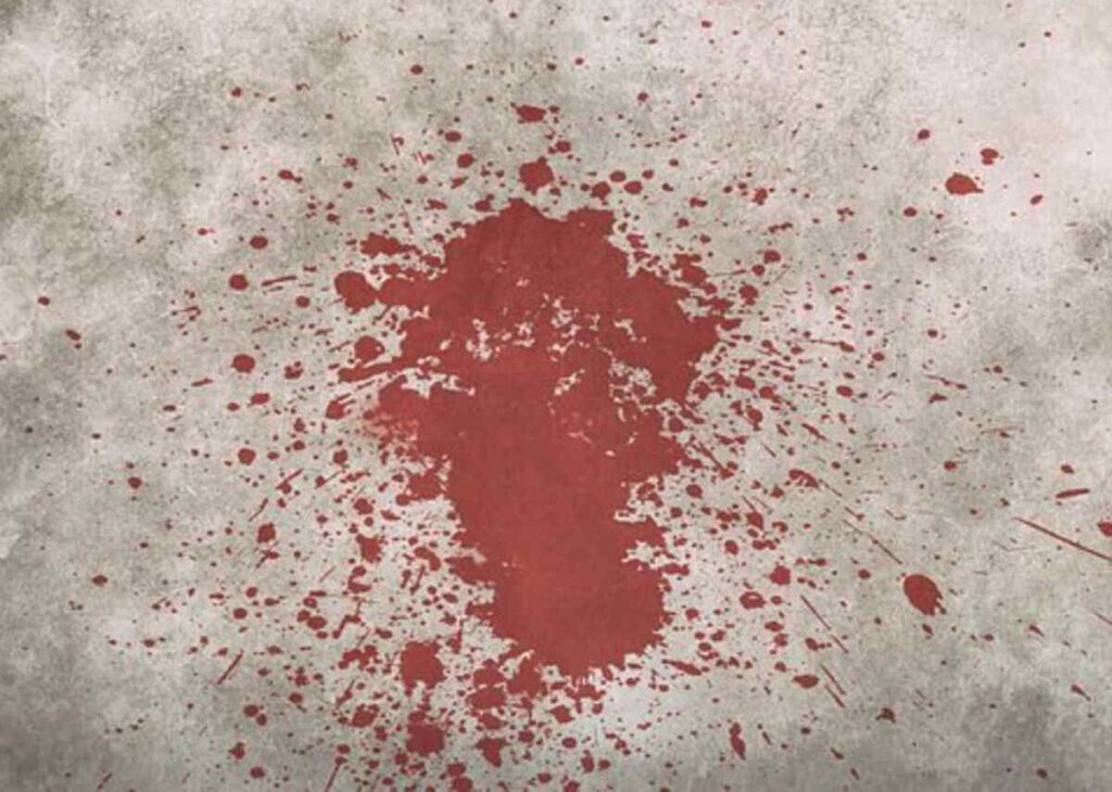how to remove blood stains